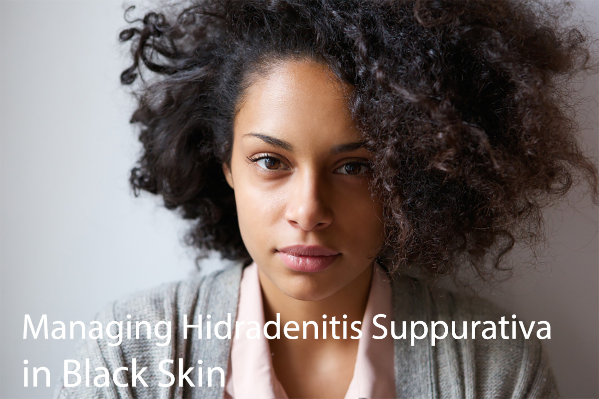 Managing Hidradenitis Suppurativa in Black Skin