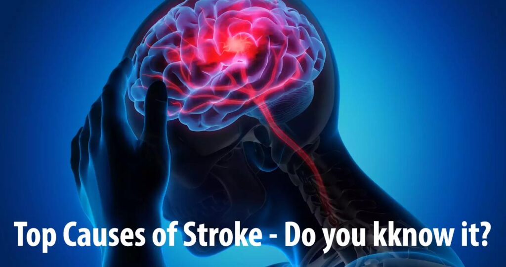 Top Causes of Stroke - Do you kknow it?