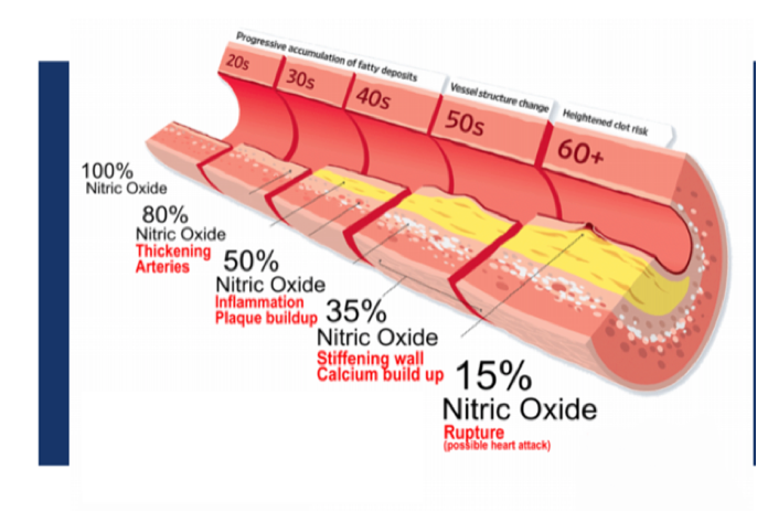 NitricOxideErectileDysfunction