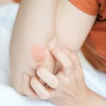 7 Of The Most Potent Antifungal Foods