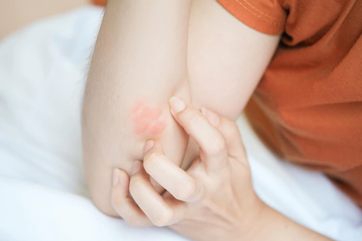 7 Of The Most Potent Antifungal Foods